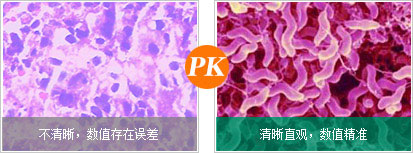 C14呼氣檢測儀優勢