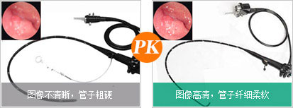 奧林巴斯無痛胃鏡優勢