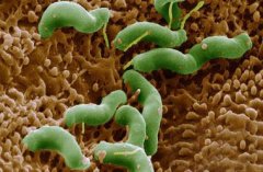 口臭是幽門螺桿菌惹的禍