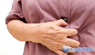 請(qǐng)問(wèn)大連廣譽(yù)遠(yuǎn)胃病醫(yī)院胃腸科專家，得了胃潰瘍嚴(yán)重嗎？